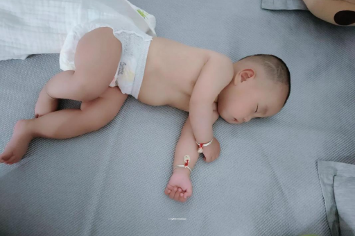 珠海六个月宝宝眼睛散光